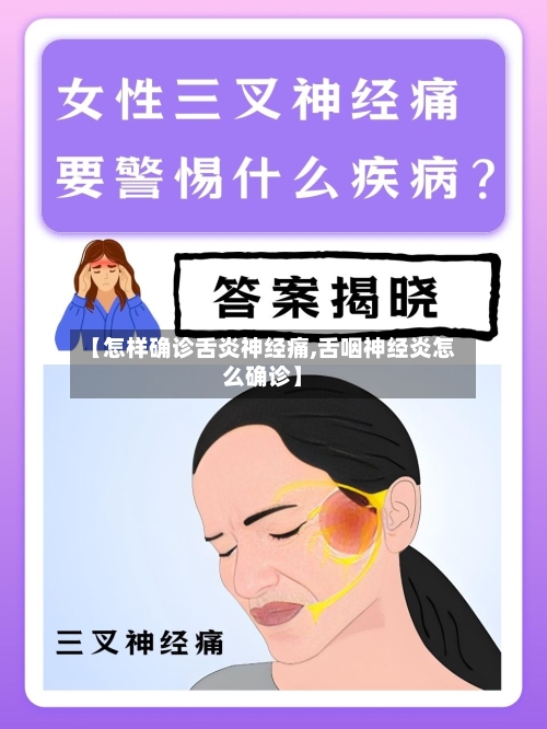 【怎样确诊舌炎神经痛,舌咽神经炎怎么确诊】