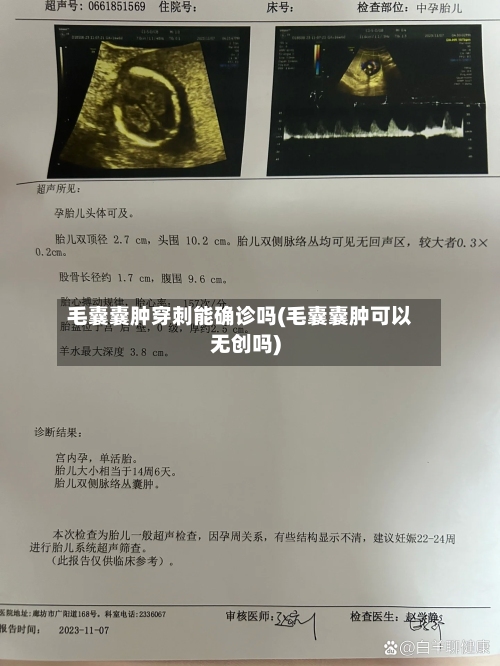 毛囊囊肿穿刺能确诊吗(毛囊囊肿可以无创吗)