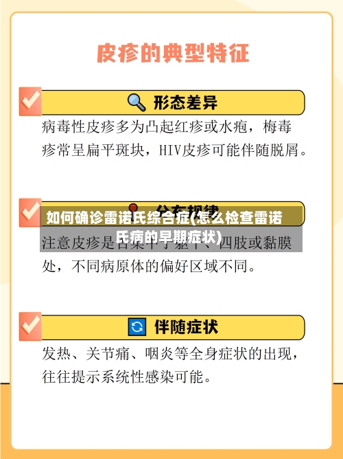 如何确诊雷诺氏综合症(怎么检查雷诺氏病的早期症状)