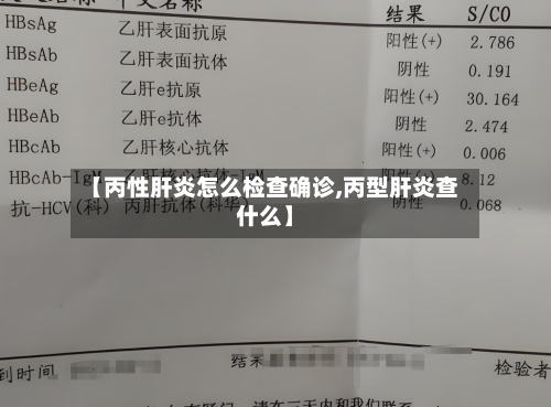 【丙性肝炎怎么检查确诊,丙型肝炎查什么】-第2张图片