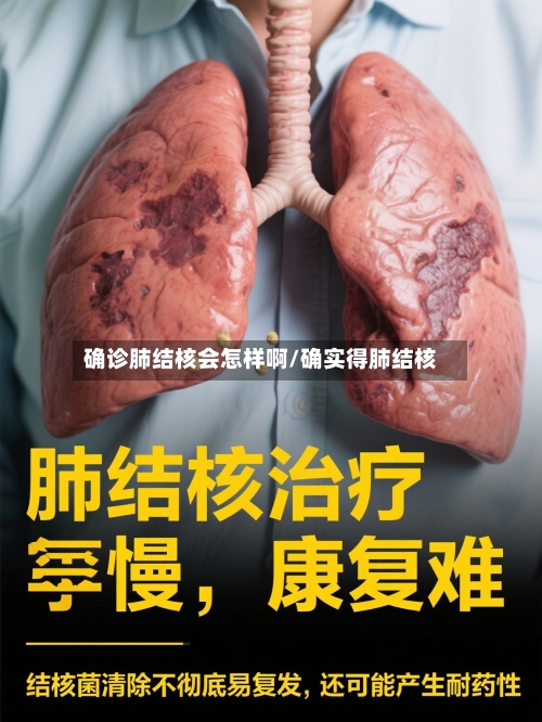 确诊肺结核会怎样啊/确实得肺结核-第2张图片