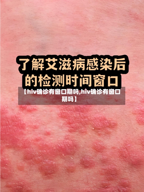 【hiv确诊有窗口期吗,hiv确诊有窗口期吗】