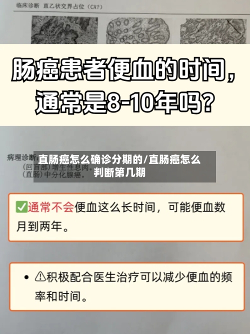 直肠癌怎么确诊分期的/直肠癌怎么判断第几期-第2张图片