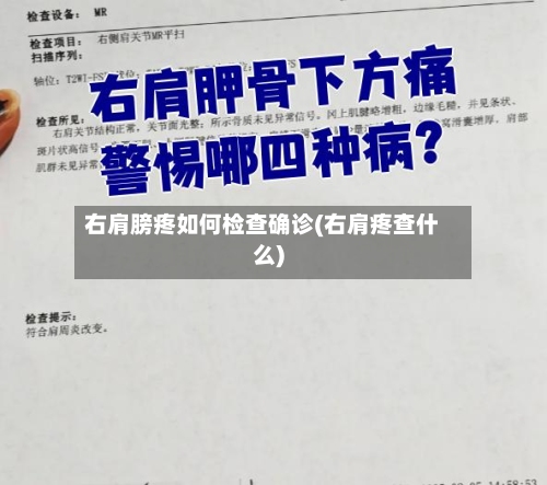 右肩膀疼如何检查确诊(右肩疼查什么)