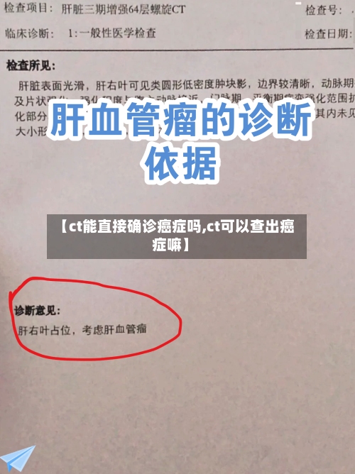 【ct能直接确诊癌症吗,ct可以查出癌症嘛】