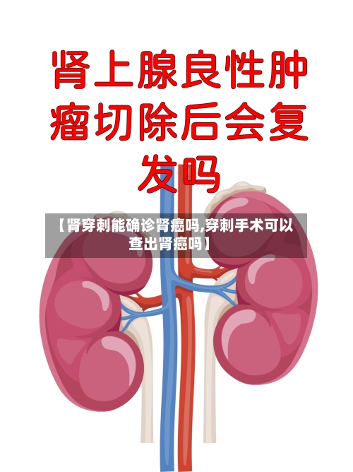 【肾穿刺能确诊肾癌吗,穿刺手术可以查出肾癌吗】