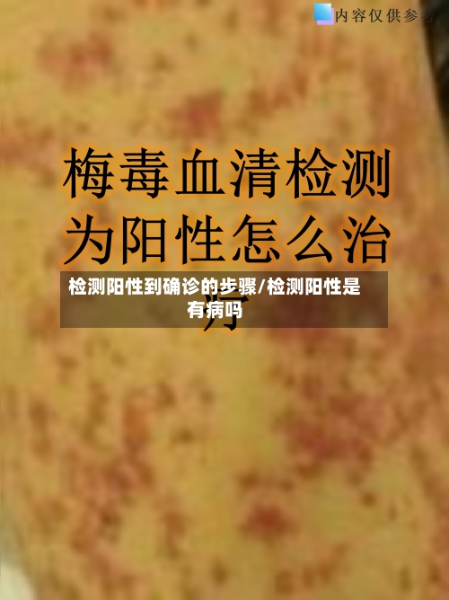 检测阳性到确诊的步骤/检测阳性是有病吗-第2张图片