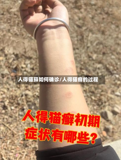 人得猫藓如何确诊/人得猫癣的过程-第3张图片