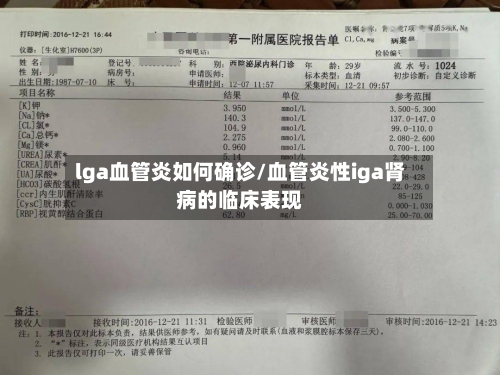 lga血管炎如何确诊/血管炎性iga肾病的临床表现