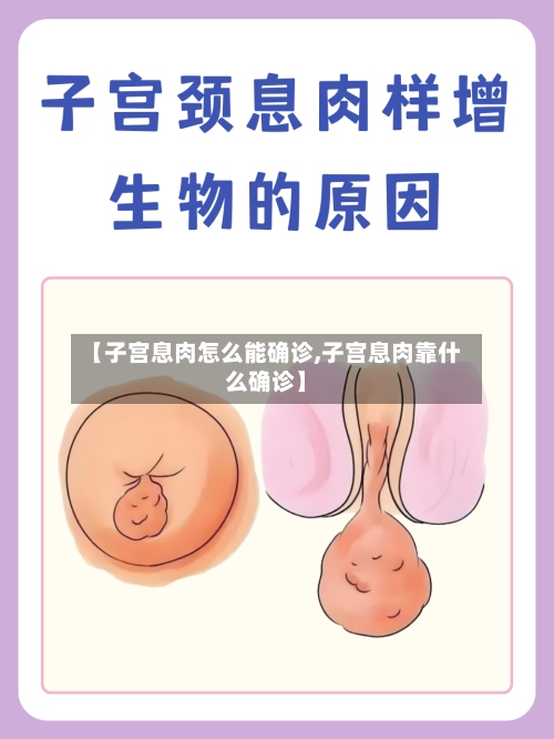 【子宫息肉怎么能确诊,子宫息肉靠什么确诊】