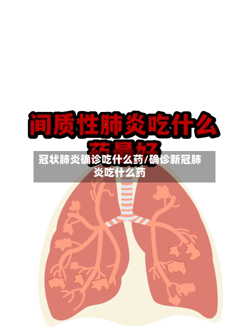 冠状肺炎确诊吃什么药/确诊新冠肺炎吃什么药