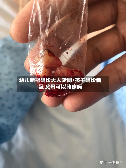 幼儿新冠确诊大人陪同/孩子确诊新冠 父母可以陪床吗
