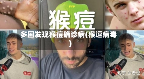 多国发现猴痘确诊病(猴逗病毒)