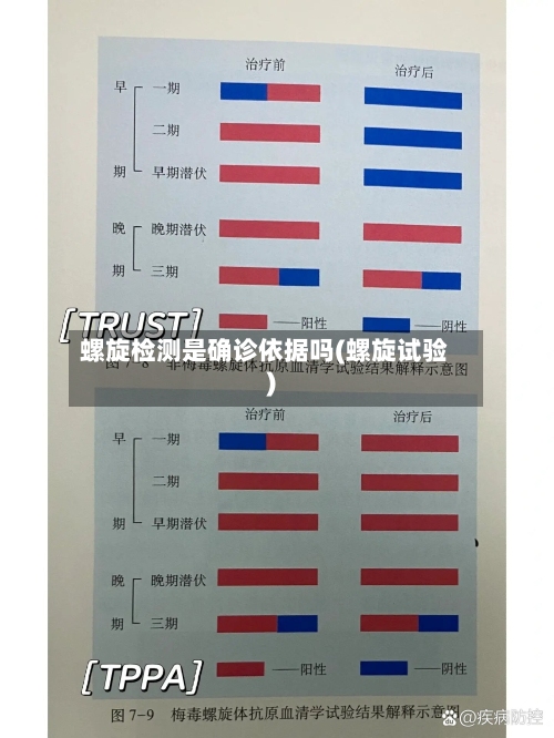 螺旋检测是确诊依据吗(螺旋试验)