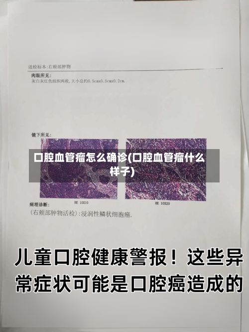 口腔血管瘤怎么确诊(口腔血管瘤什么样子)-第2张图片