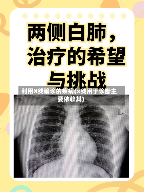 利用X线确诊的疾病(x线用于诊断主要依赖其)