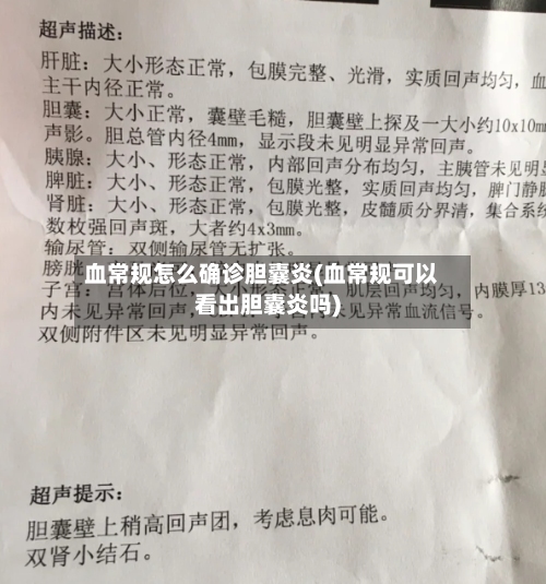 血常规怎么确诊胆囊炎(血常规可以看出胆囊炎吗)-第3张图片