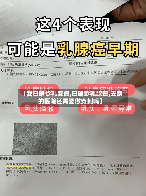 【我已确诊乳腺癌,已确诊乳腺癌,去别的医院还需要做穿刺吗】-第3张图片