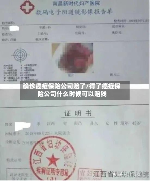 确诊癌症保险公司赔了/得了癌症保险公司什么时候可以赔钱