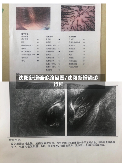沈阳新增确诊路径图/沈阳新增确诊行程-第2张图片